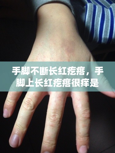 手脚不断长红疙瘩，手脚上长红疙瘩很痒是什么 