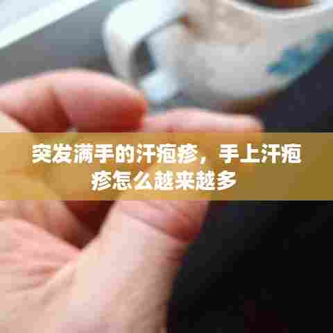突发满手的汗疱疹，手上汗疱疹怎么越来越多 