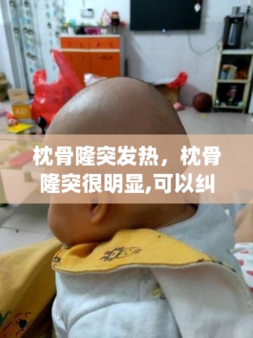 枕骨隆突发热，枕骨隆突很明显,可以纠正吗 